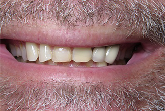 Before