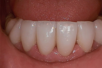 After
