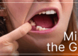 Woman holding open mouth showing a missing tooth