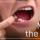 Woman holding open mouth showing a missing tooth