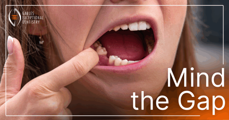 Woman holding open mouth showing a missing tooth