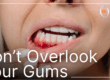 Woman with gum disease