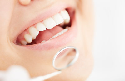 What Are CEREC Implants?