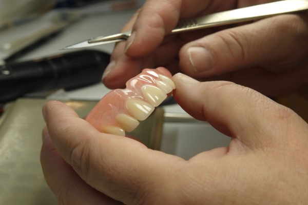 Denture Repair Questions: How Are Dentures Rebased?
