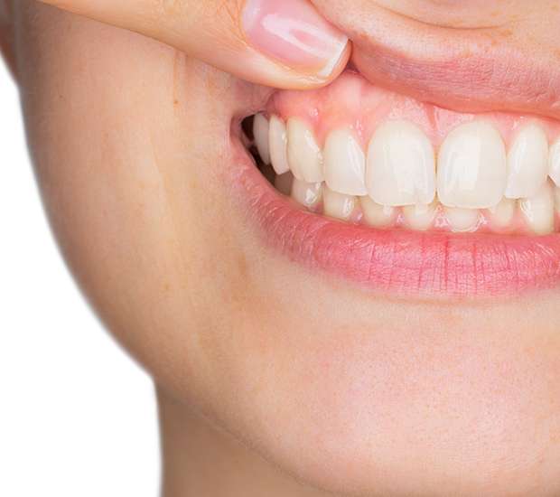 Coral Gables Gum Disease