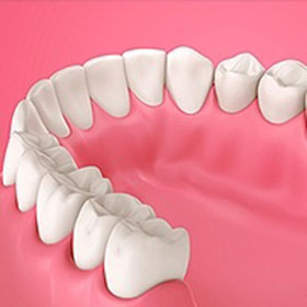 Periodontics Coral Gables, FL