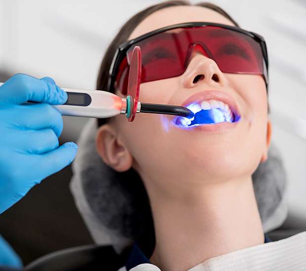 Coral Gables Professional Teeth Whitening