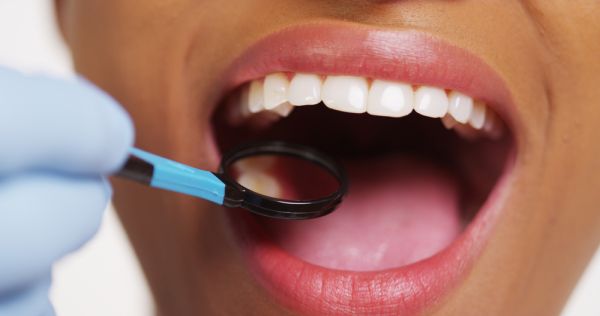 Health Benefits Of Mercury Free Dentistry