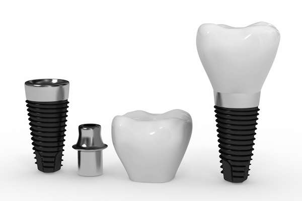 What Are the Parts of Dental Implants from Gables Exceptional Dentistry in Coral Gables, FL