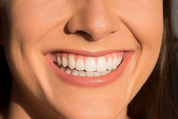 Why Choose Dental Bonding?
