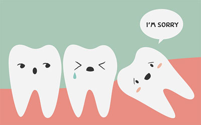 10 Easy Facts About Wisdom Teeth Coming In Shown